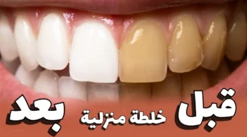 اخفوها عنك الأطباء سنوات وصفة منزلية فعالة لتبييض الأسنان وتخلصك من الاصفرار والجير بمكونات بسيطة